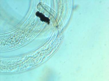 head of female nematode